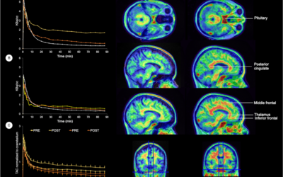 La transición en menopausia, también es cerebral